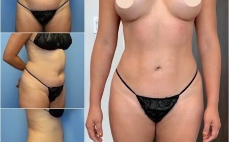 Sculpt Your Ideal Body with Body Contouring in Dubai