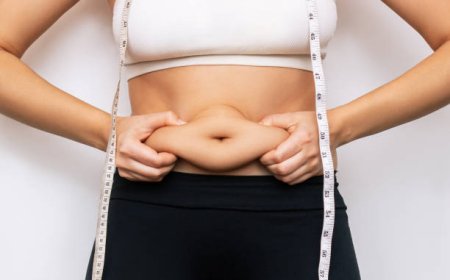 Liposuction in Islamabad: What to Know Before You Go