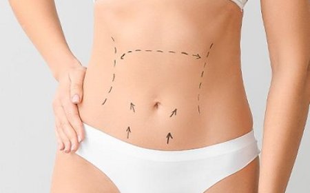 Sculpt Your Dream Body with an Expert Liposuction Surgeon in Riyadh