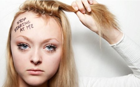 A Guide to Treating Hair Pulling Disorder: Comprehending and Getting Rid of Trichotillomania
