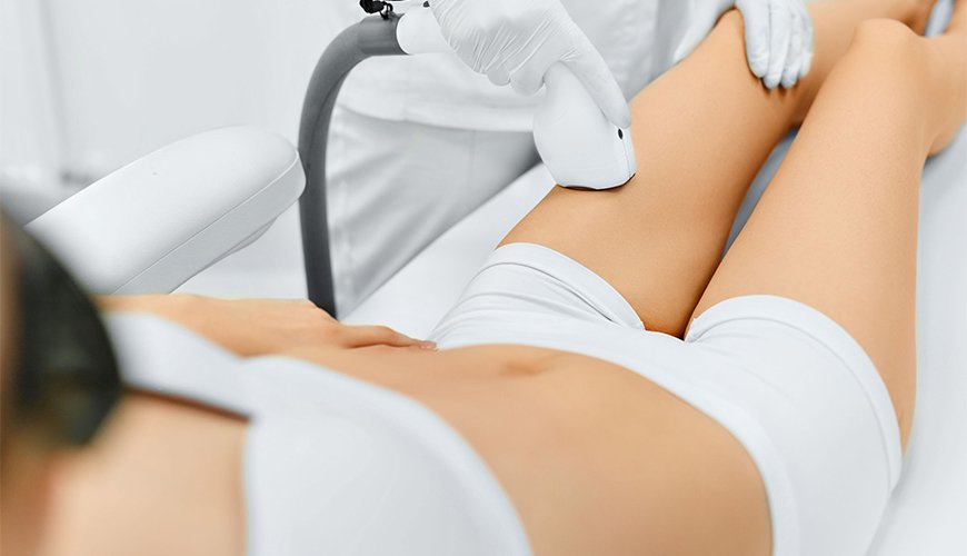 How to Prepare for Laser Hair Removal Jeddah?